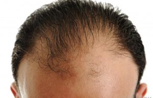 男の髪でカットの頻度で期間が伸びるのは変？（静岡の毛髪の悩み）